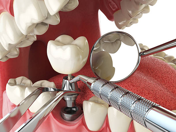 Best Emergency Dental Services for Seniors in Applewood, CO